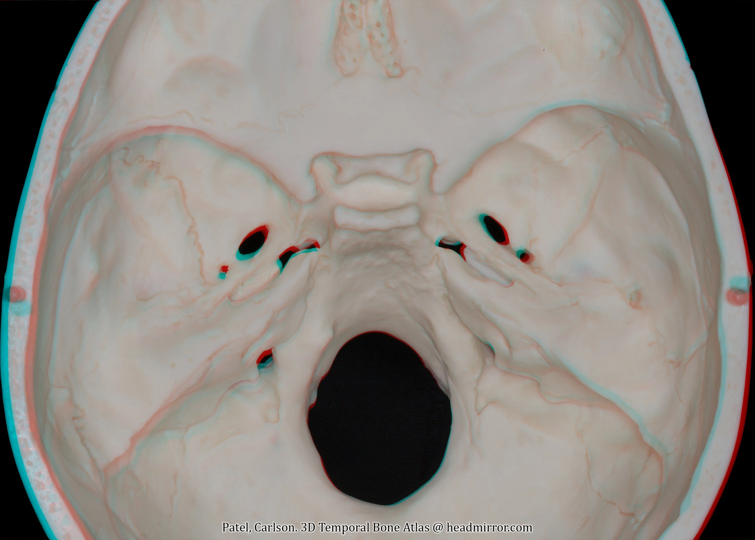 Overview of Anatomy — Headmirror